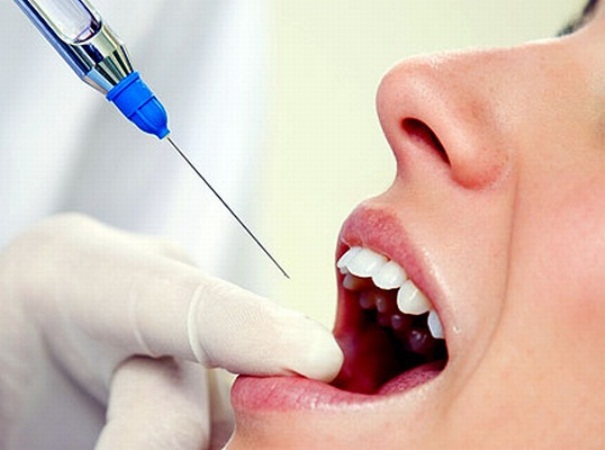 Анестезия в стоматологии. 